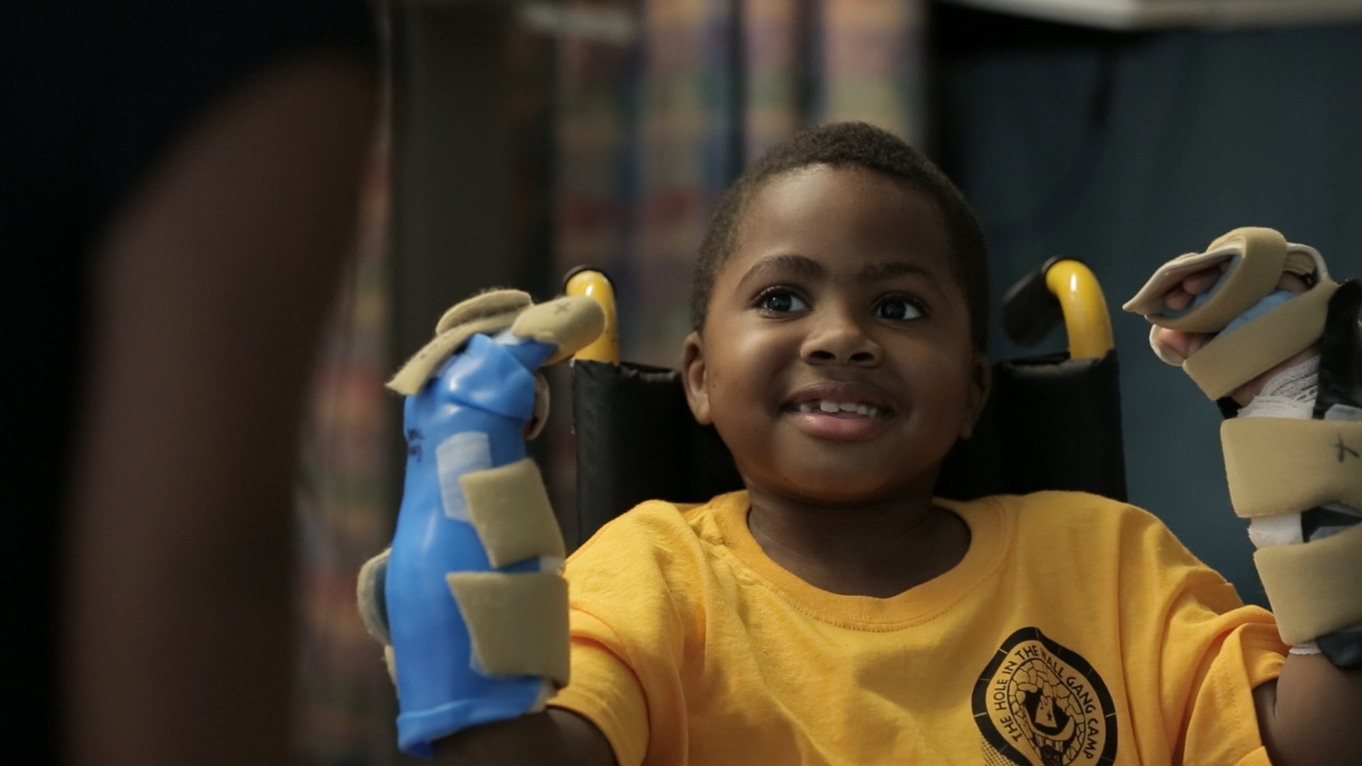 A team of 12 surgeons and other medical professionals at the Children's Hospital of Philadelphia successfully completed a double hand transplant. The patient -- 8-year-old Zion Harvey -- had his hands amputated at the age of 2 due to a life-threatening sepsis infection.