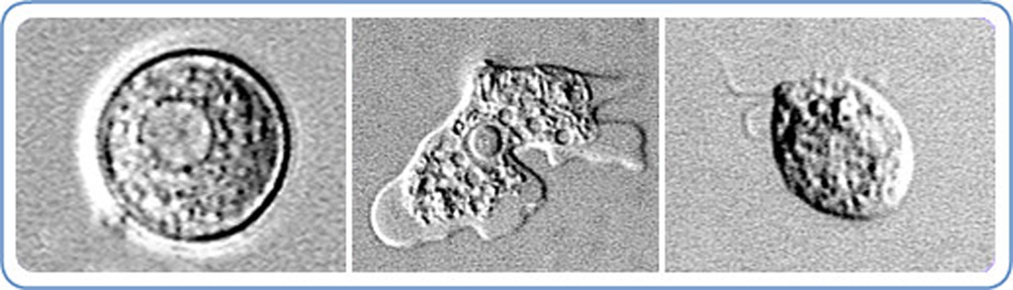 Naegleria fowleri enters the body through the nose and travels to the brain. It's usually found in people who have been swimming in warm freshwater. The amoeba causes a fatal brain infection, according to the CDC.