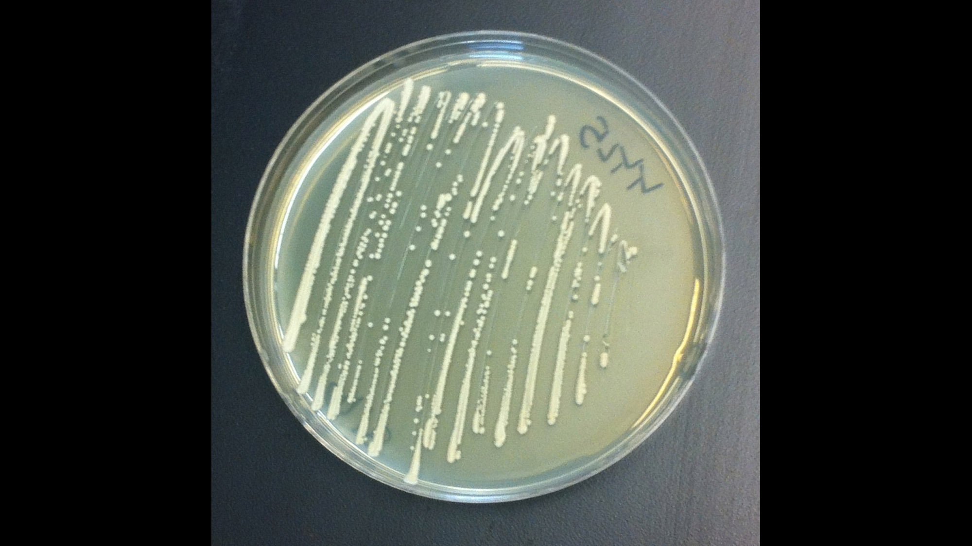 These bioengineered strains of yeast can produce synthetic narcotics.