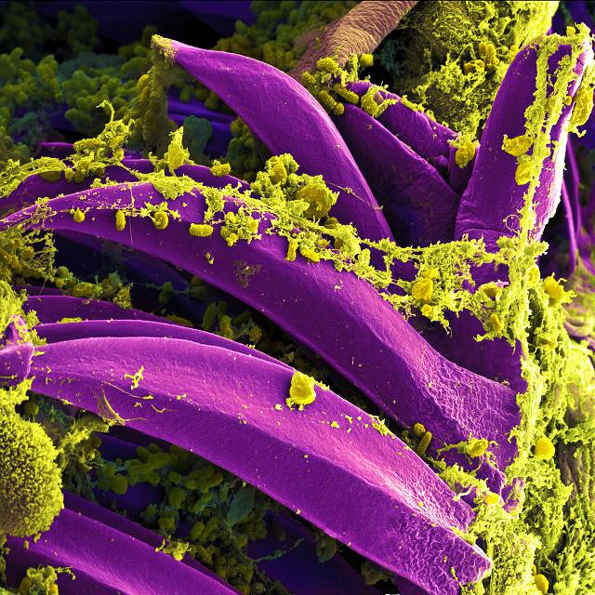 Purple-colored Yersinia pestis bacteria, the bacteria that causes the plague, seen on the spines of a flea.

Credit: National Institute of Allergy And Infectious Diseases