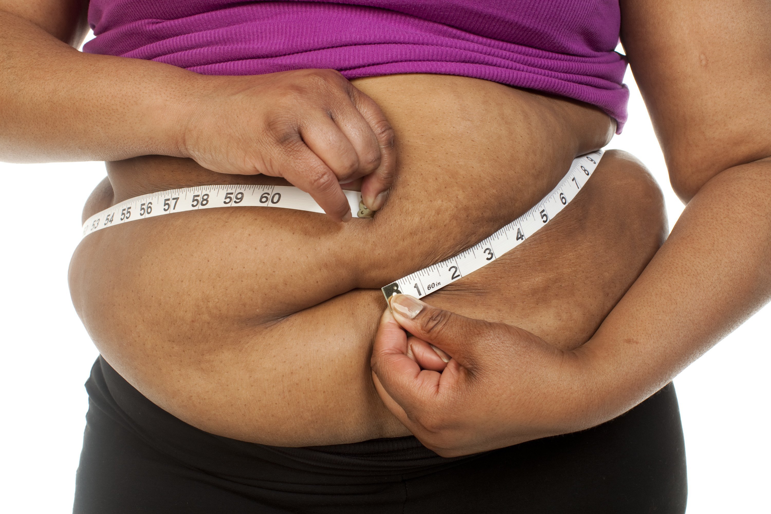 [FILE] A stock photograph detailing the midsection or belly an unidentified obese woman.