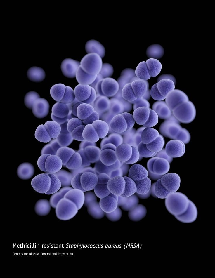 Pictured: Methicillin-resistant Staphylococcus aureus (MRSA)

For the first time, the CDC is categorizing antibiotic-resistant organisms by threat level. That's because, in their conservative estimates, more than 2 million people get antibiotic-resistant infections each year, and at least 23,000 die because current drugs no longer stop their infections.