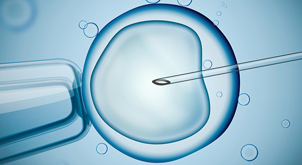 Laboratory microscopic research of IVF (in vitro fertilization).