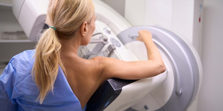 Back view of Caucasian female patient undergoing 3D mammography in radiology room